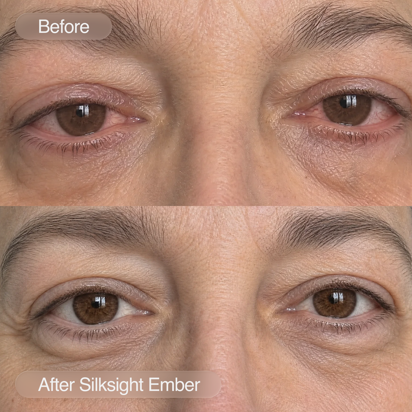 Silksight Ember / Heated Eye Mask