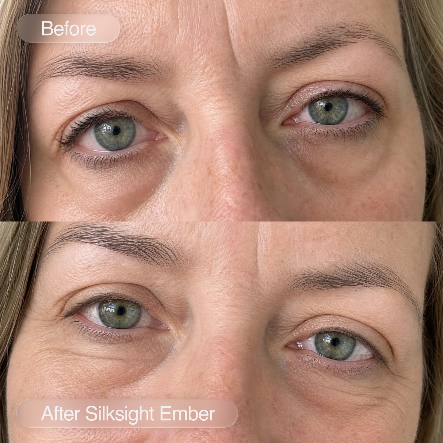 Silksight Ember / Heated Eye Mask